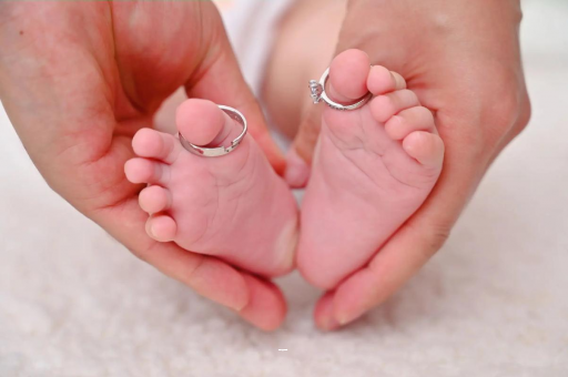 长沙怀孕妊娠线不明显